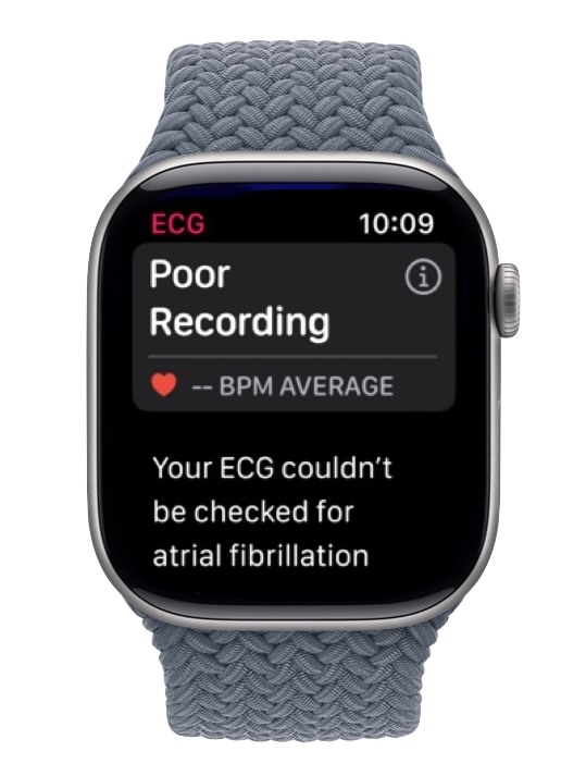 Apple Watch showing a Poor Recording ECG result that could not be checked for atrial fibrillation