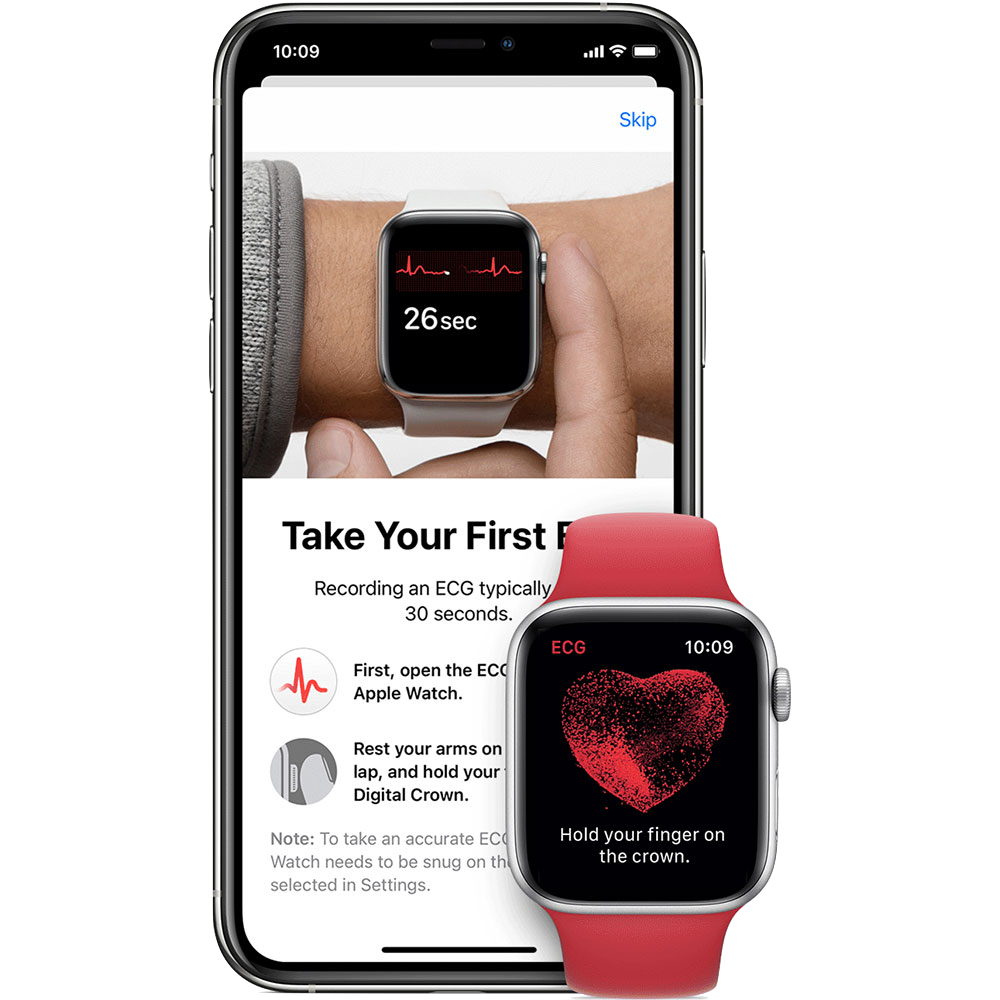 Eine Apple Watch erstellt eine EKG-Aufzeichnung
