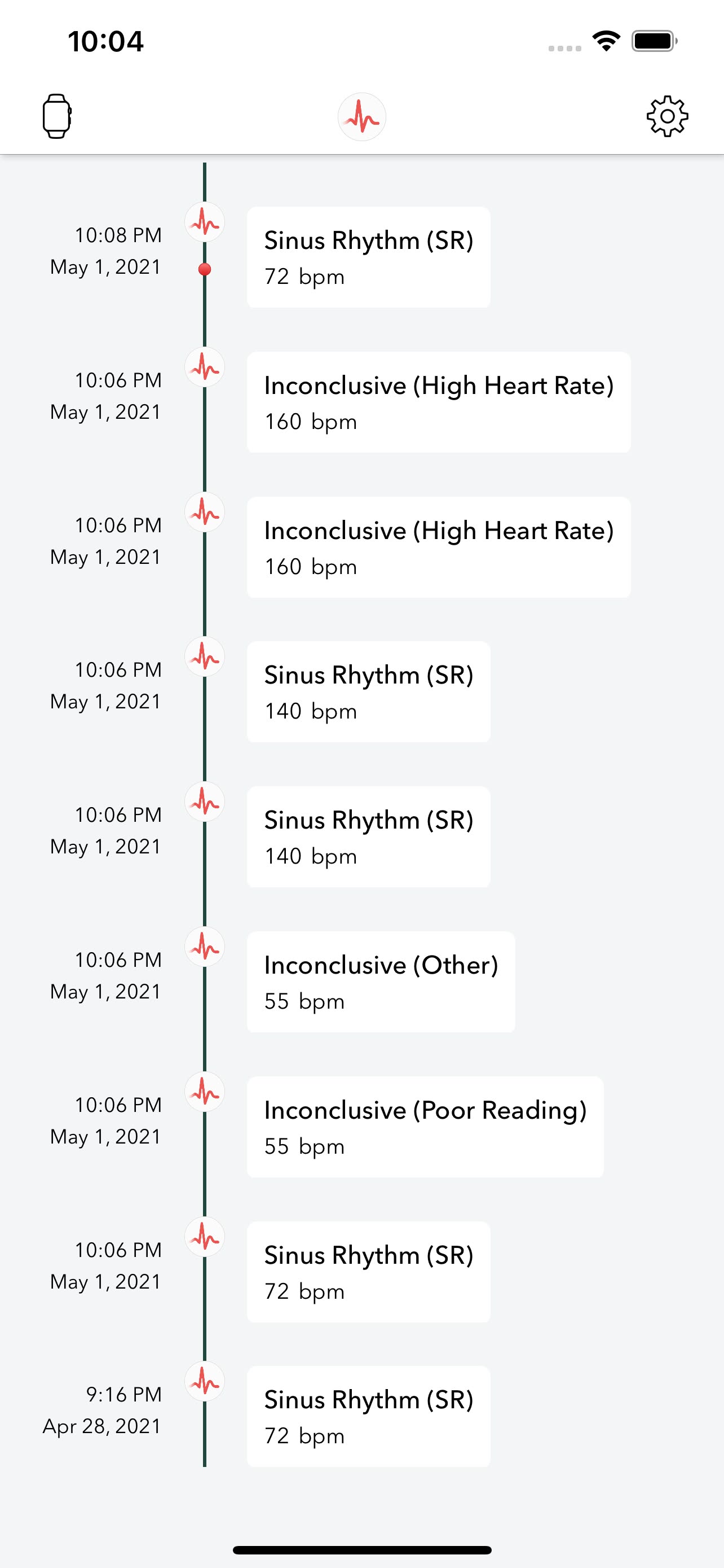 An early ECG+ screen from 2021 showing the recording timeline view of ECG history over time