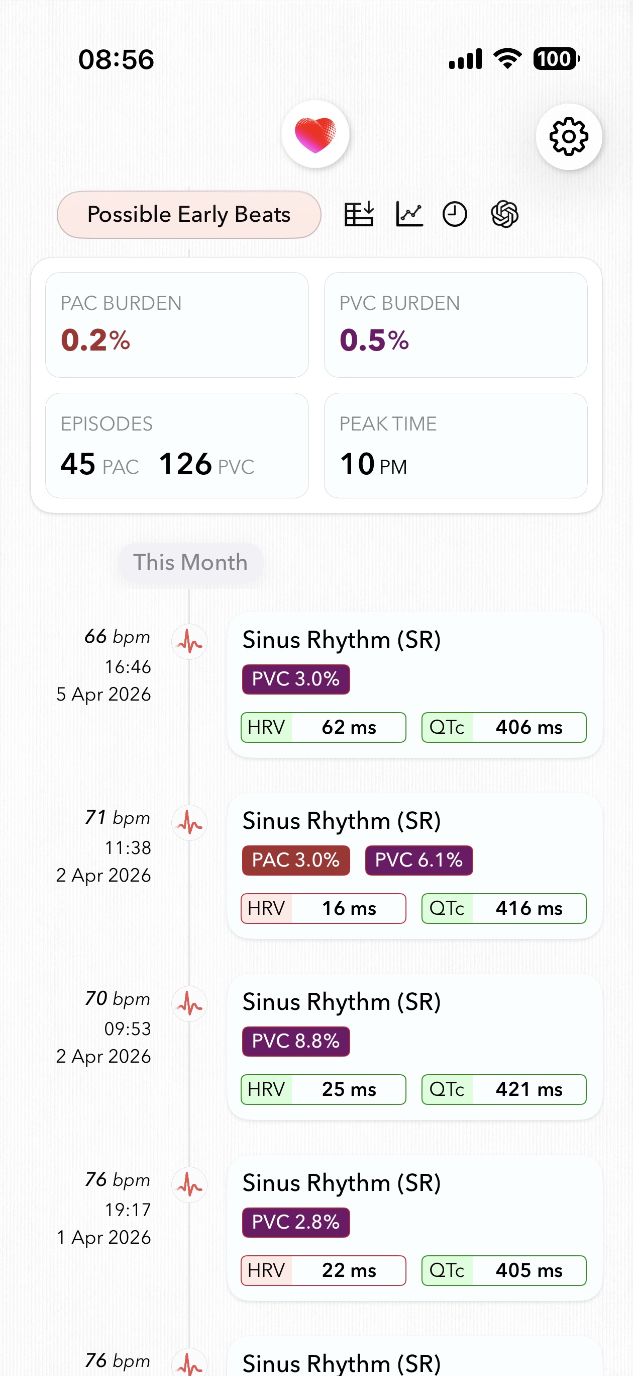 ECG+ app screenshot showing PAC burden calculated for Apple Watch ECG recordings