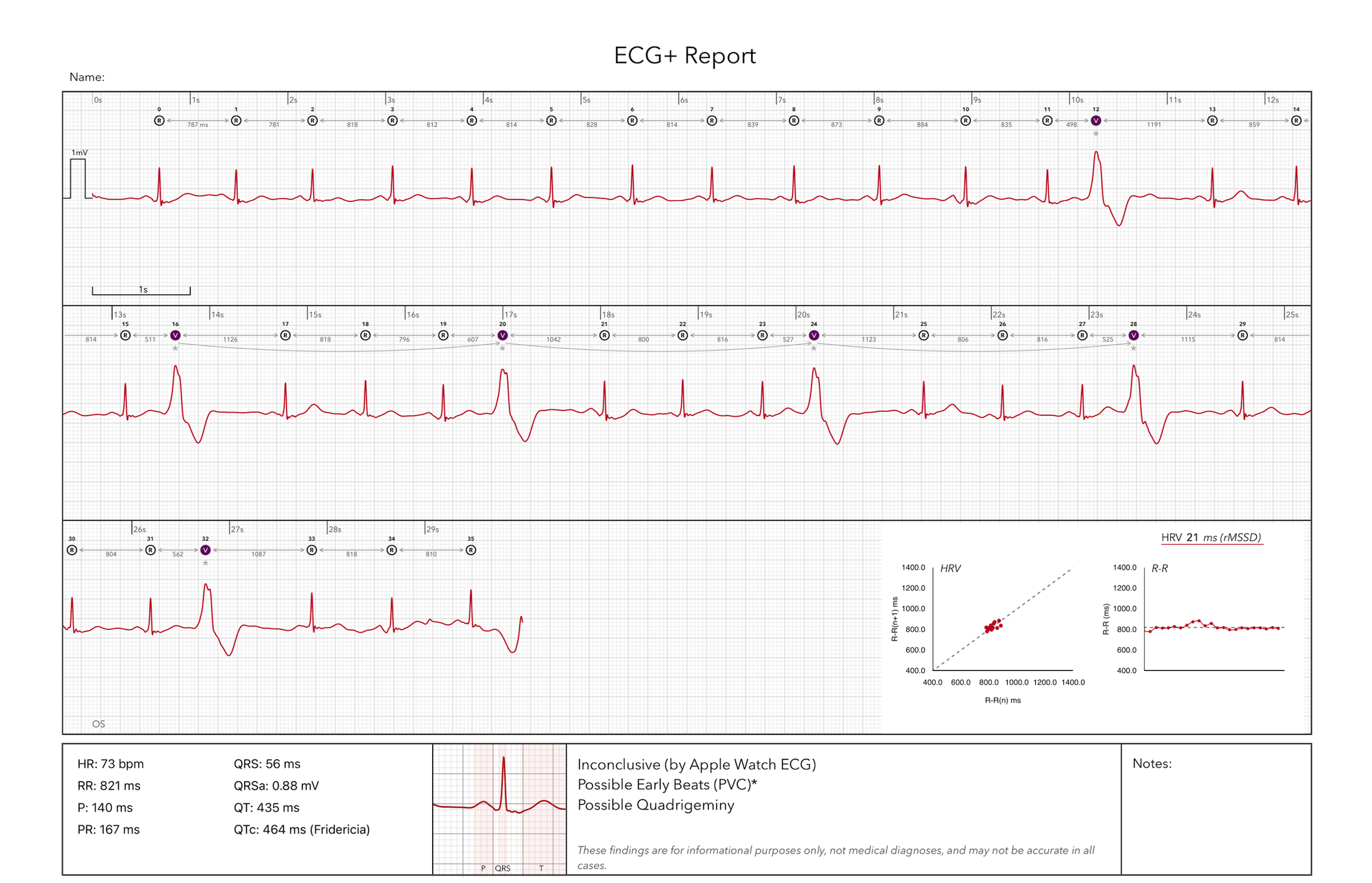 ECG+ Bericht mit Apple Watch EKG-Befunden, bereit zum Teilen mit der Ärztin oder dem Arzt